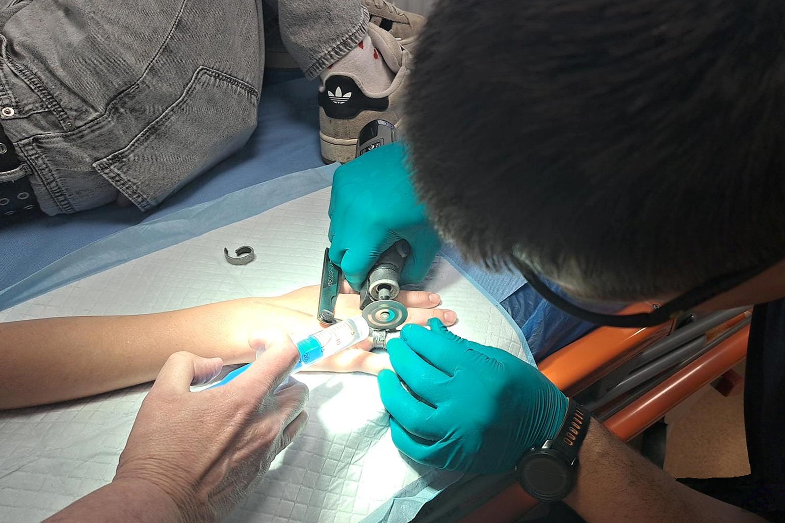 090625-Pomoc se sundáním prstýnku z tvrdé oceli na chirurgickém oddělení Oblastní nemocnice Příbram.jpg